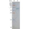 page-FLP100100 CCR5 Fig.2 SDS PAGE 1