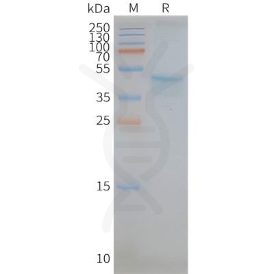 page-FLP100100 CCR5 Fig.2 SDS PAGE 1