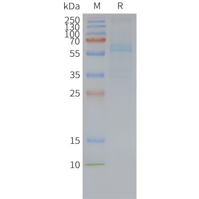 page-FLP100109 FZD7 Fig.2 SDS PAGE 1