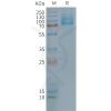 page-FLP100113 GLP2R Fig.2 SDS PAGE 1