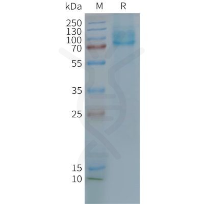 page-FLP100113 GLP2R Fig.2 SDS PAGE 1