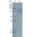 page-FLP100114 F2RL3 Fig.2 SDS PAGE 1