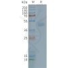 page-FLP100115 CX3CR1 Fig.2 SDS PAGE 1