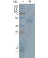 page-FLP100115 CX3CR1 Fig.2 SDS PAGE 1