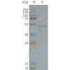page-FLP100118 GRPR Fig.2 SDS PAGE 1