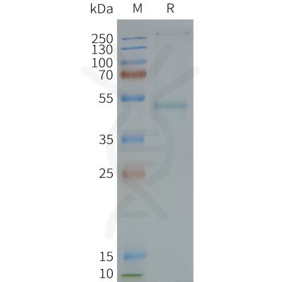 page-FLP100118 GRPR Fig.2 SDS PAGE 1