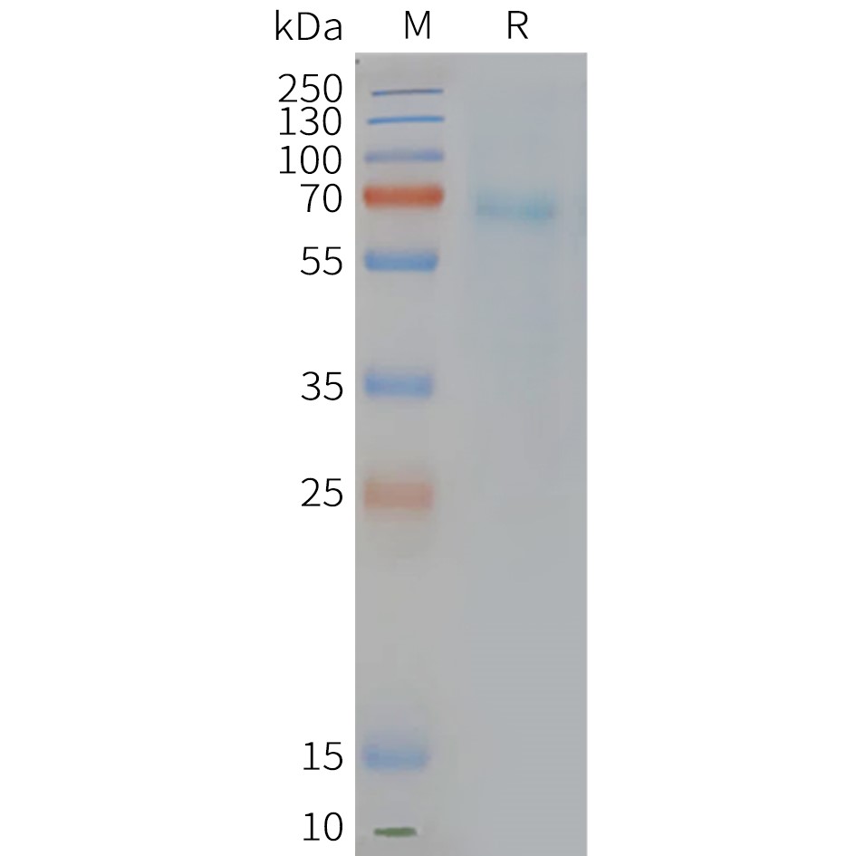 FLP100125-PTGDR2-Fig.2-SDS-PAGE-1.jpg