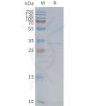 page-FLP100134 FFAR1 Fig.2 SDS PAGE 1