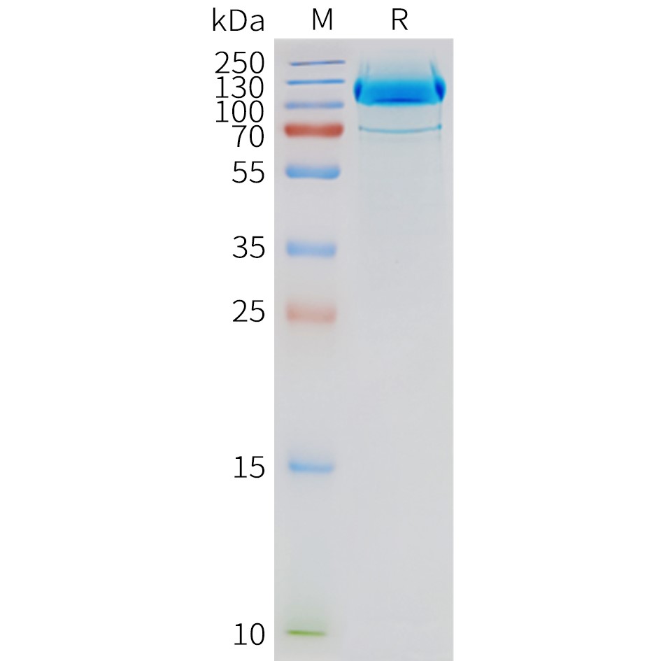 FLP100135-GRM2-Fig.2-SDS-PAGE-1.jpg