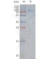 page-FLP100136 UTS2R Fig.2 SDS PAGE 1