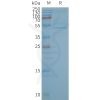 page-FLP100138 CB2 Fig.2 SDS PAGE 1