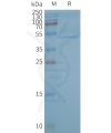 page-FLP100138 CB2 Fig.2 SDS PAGE 1