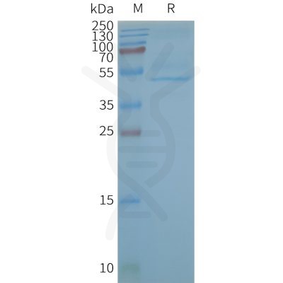 page-FLP100138 CB2 Fig.2 SDS PAGE 1