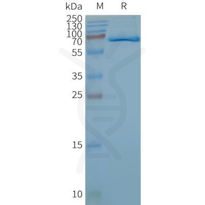 page-FLP100139 FZD4 Fig.2 SDS PAGE 1