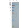 page-FLP100140 TLR2 Fig.2 SDS PAGE 1
