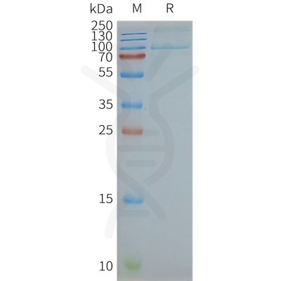page-FLP100140 TLR2 Fig.2 SDS PAGE 1
