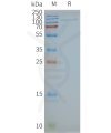page-FLP100141 TLR4 Fig.2 SDS PAGE 1