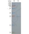 page-FLP100142 CAV1 Fig.2 SDS PAGE 1