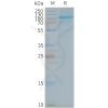 page-FLP100143 TLR5 Fig.2 SDS PAGE 1