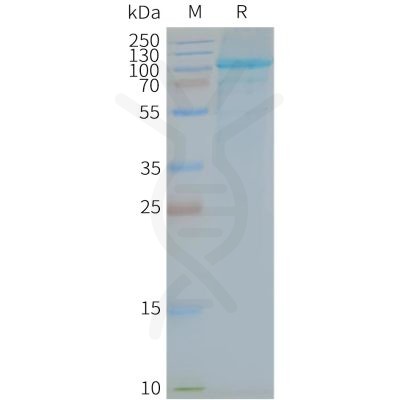 page-FLP100143 TLR5 Fig.2 SDS PAGE 1
