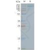 page-FLP100144 TLR7 Fig.2 SDS PAGE 1