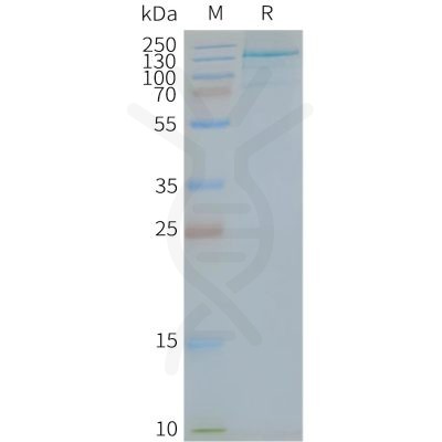 page-FLP100144 TLR7 Fig.2 SDS PAGE 1