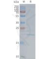 page-FLP100149 EMP2 Fig.2 SDS PAGE 1