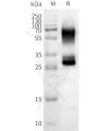 page-FLP100151 OR2B3 Fig.2 SDS PAGE 1