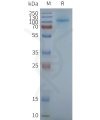 page-FLP100154 TAS1R3 Fig.2 SDS PAGE 1