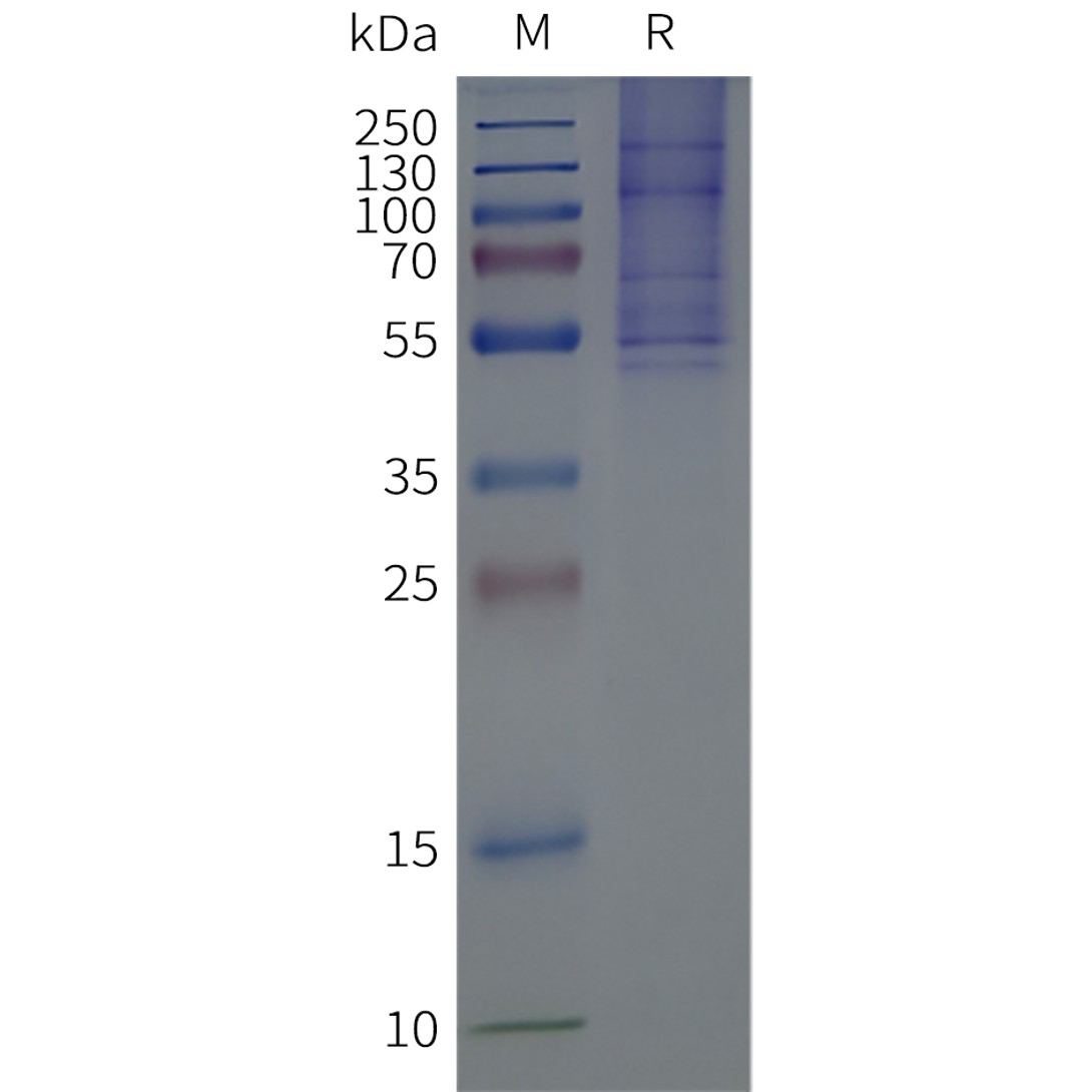 flp-m100031-gpr75-sp1.png