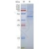 page-flp100062 gpr87 sp1