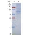 page-flp100062 gpr87 sp1