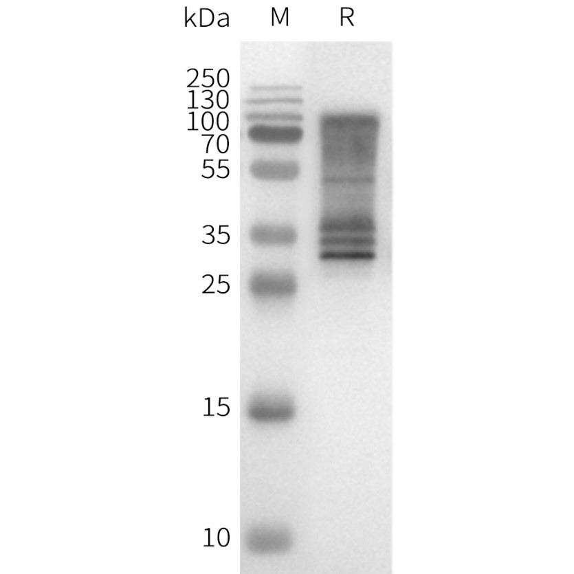 flp100092-gnrhr-sp1.jpg