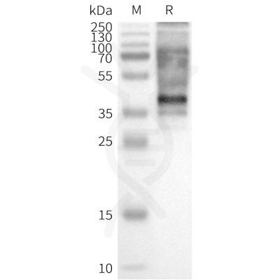page-flp100103 gpr65 sp1