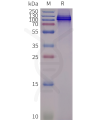 page-flp100128 trpv1 sp1