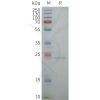page-flp100158 aqp5 sp1