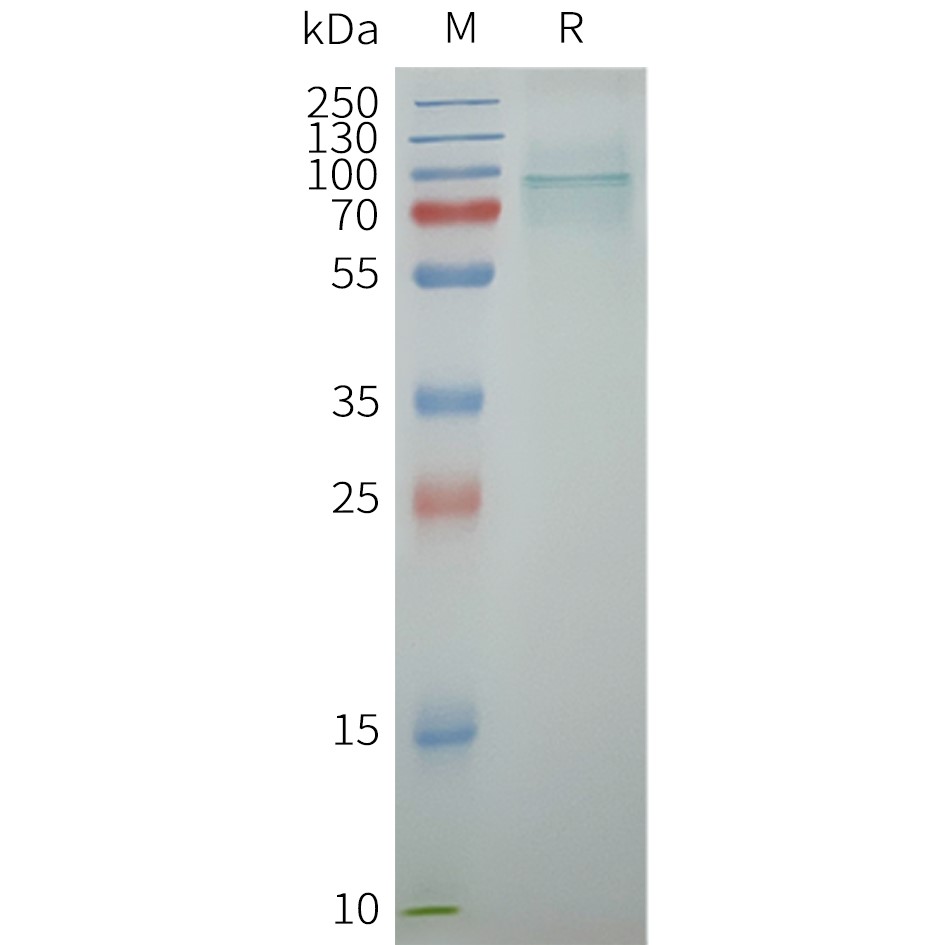 flp100159-trpv6-sp1.jpg