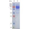 page-flp100186 adra2a sp1