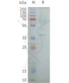 page-flp100429 oxyr sp1