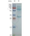 page-flp100616 cacng1 sp1