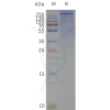 page-flp100723 scn2a sp1