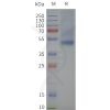 page-flp120013 sstr2 strep sp1