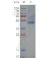 page-flp120013 sstr2 strep sp1