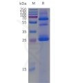 page-flp120014 cldn18.2 strep sp1