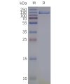 page-flp120033 trpa1 strep sp1