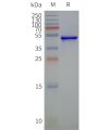page-flp120043 steap2 strep sp1