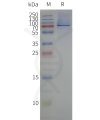 page-flp120047 fshr strep sp1