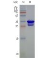 page-flp120070 steap1 strep sp1