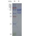 page-flp120074 cxcr4 strep sp1