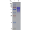 page-flp120102 prokr1 strep sp1
